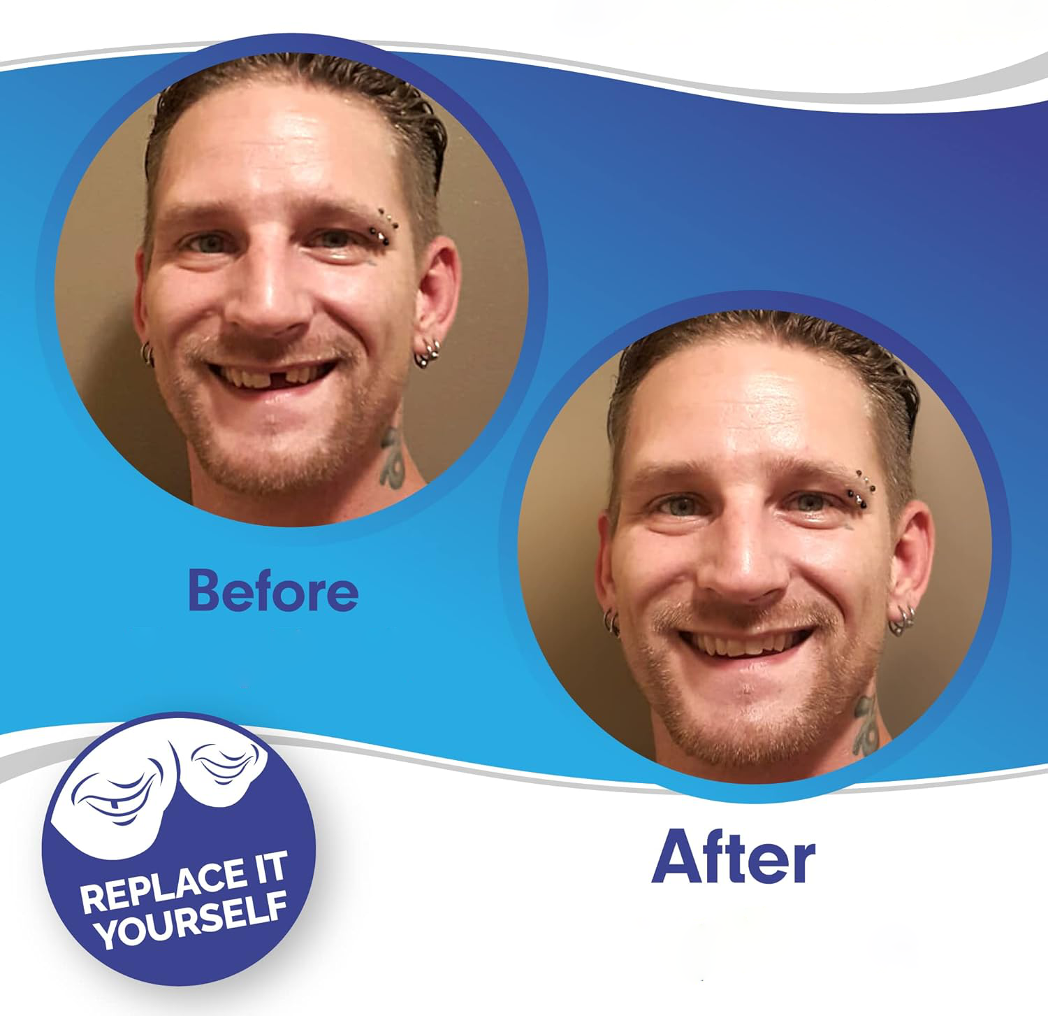 Custom Fit Veneers | Snap-On Solution for Instant Smile Transformation | Comfortable, Durable Design for Flawless Confidence 1